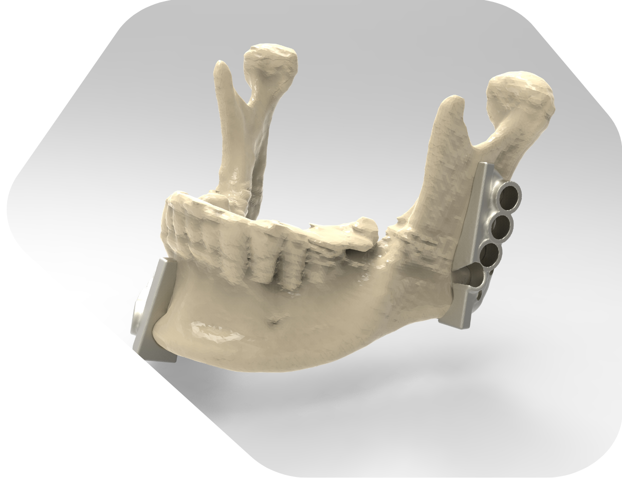 Digital skull visualization